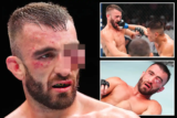 🥊 Mohammad Yahya Eye injury @ UFC Abu Dhabi on July 26, 2025